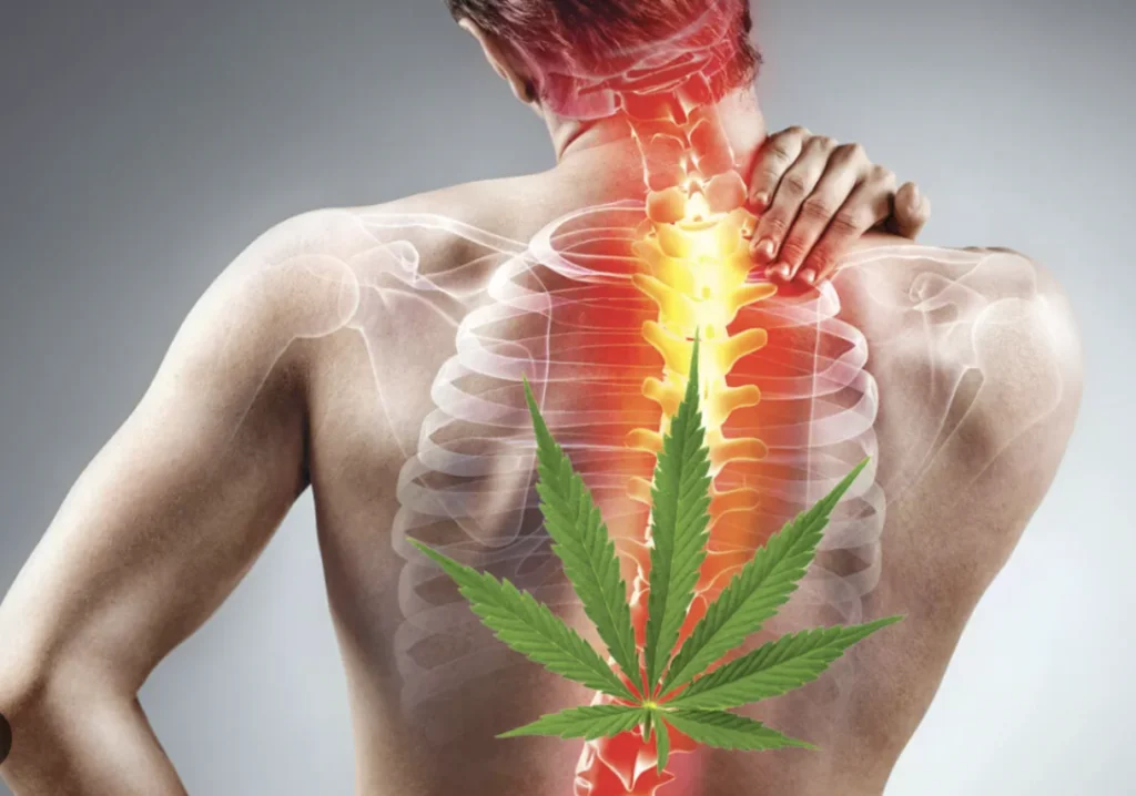 dor cannabis fitocanabinoides